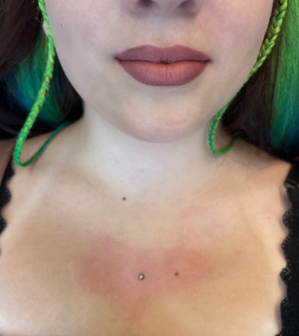Školenie Microdermal Piercing
